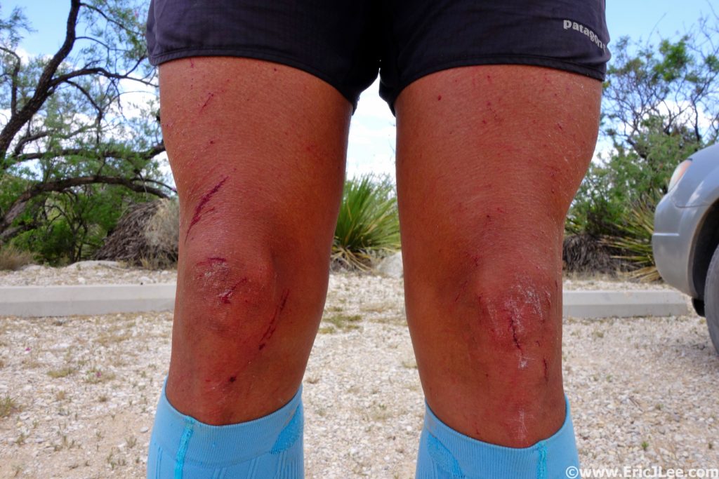 The ravages of yucca and cats claw, bloody legs.